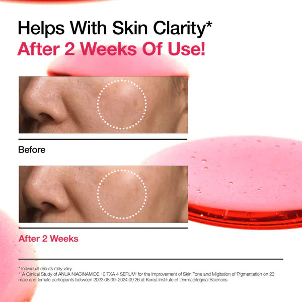 Anua Anua Niacinamide 10% + TXA 4% Serum 30ml