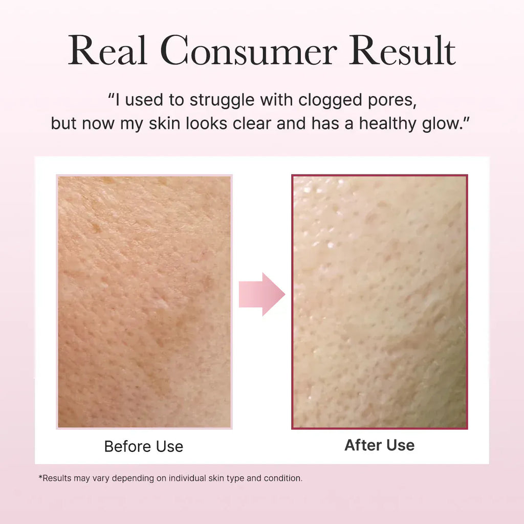 Arencia [Arencia] Fresh Rosehip Rice Mochi Cleanser 120g