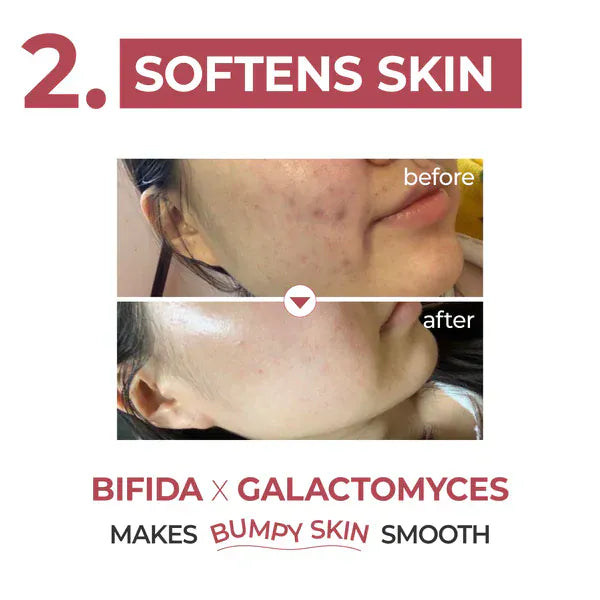 Numbuzin [numbuzin] No.3 Skin Softening Serum 50ml