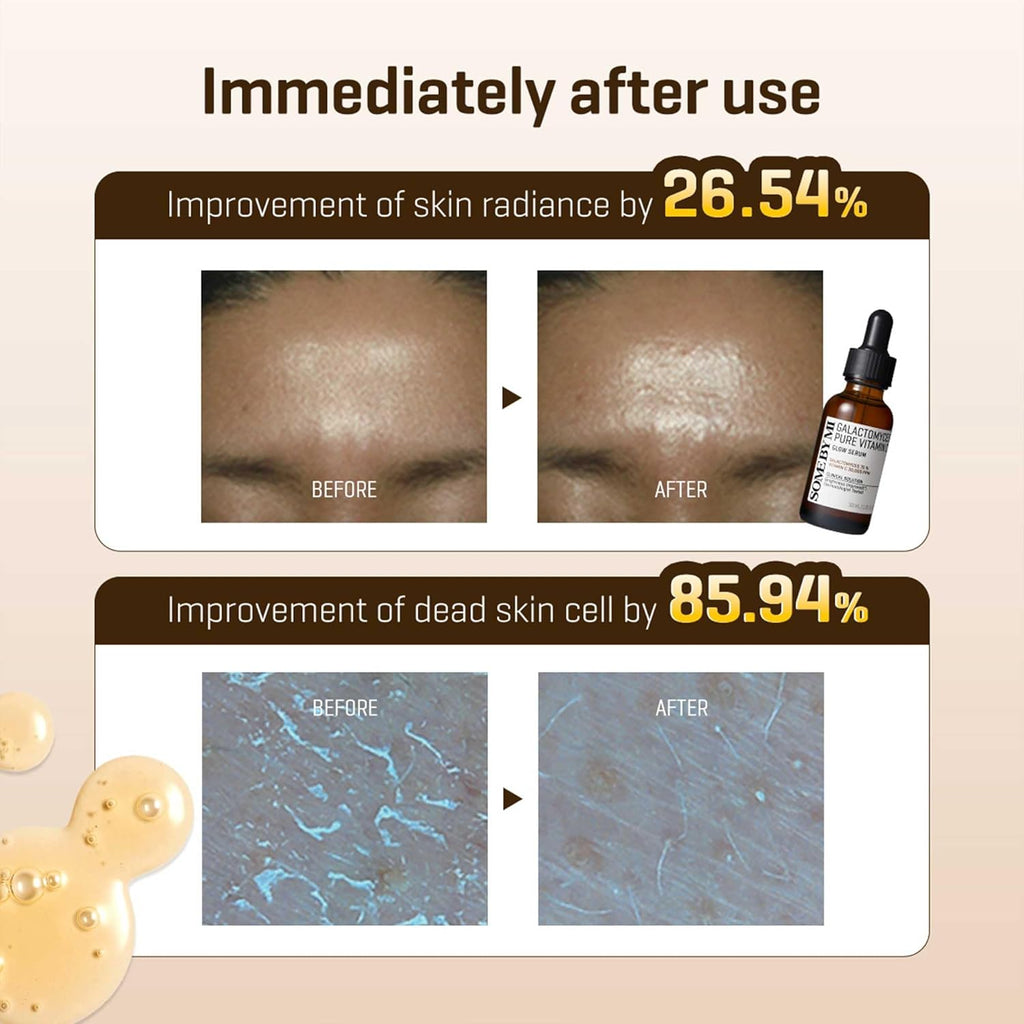 SOME BY MI [SOME BY MI] Galactomyces Pure Vitamin C Glow Serum 30ml